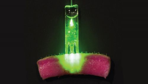 Fibre to the surgery